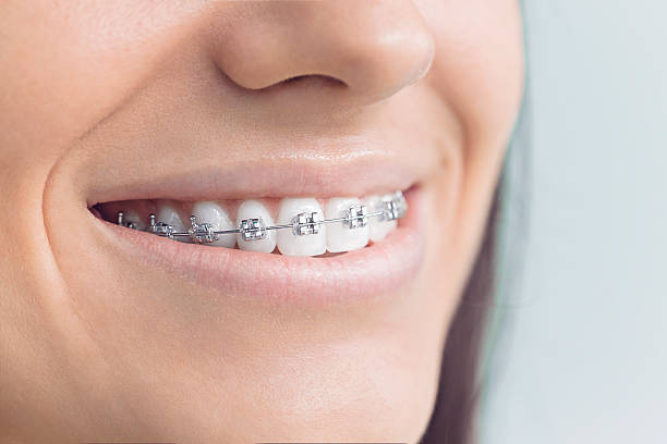 Dental Inlays and Onlays in Bath, MI